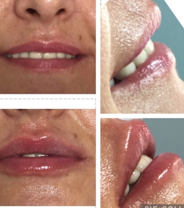 8b418582-427b-4958-93dc-ca2ad372de28